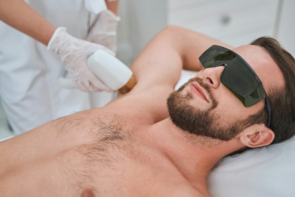 Underarm Laser Hair Removal