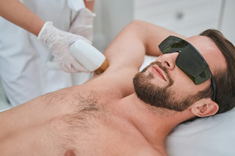 Underarm Laser Hair Removal
