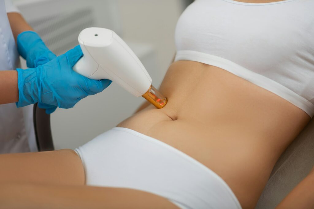 laser lipo